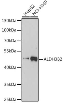 Western Blot: ALDH3B2 AntibodyAzide and BSA Free [NBP3-04930]